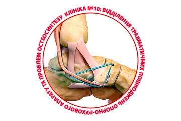 Что такое динамическая стабилизация связок голеностопного сустава Internal Brace?