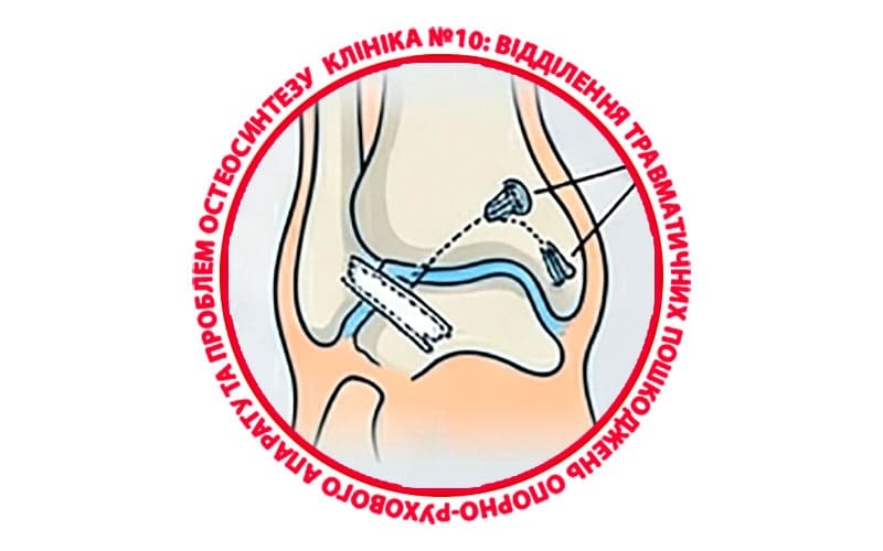 Что такое артроскопическая реконструкции связок голеностопного сустава All-Inside?