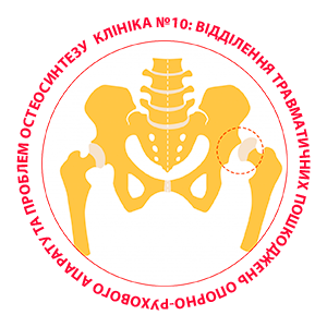 Вивих стегна