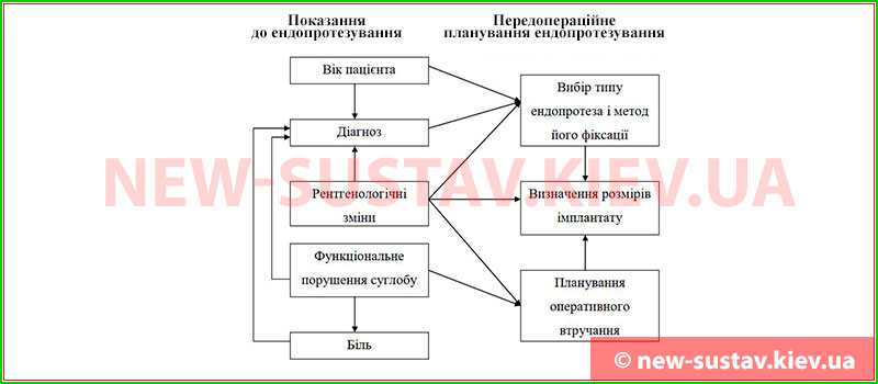 Схема взаємозв'язку діагностичних критеріїв і передопераційного планування ендопротезування кульшового суглобу у Києві | Клініка № 10 ІТО НАМН України